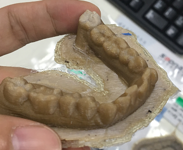 打印牙齒模型 打印牙齒模型